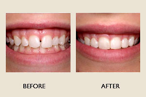 Cosmetic Dentistry