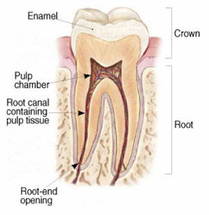 Root Canal Therapy