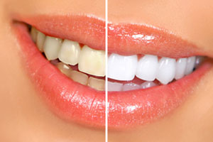 Cosmetic Dentistry